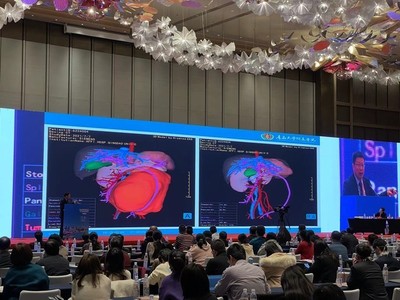 青大附院院长董蒨 海信CAS走向全球，展示中国根技术在国际前沿舞台