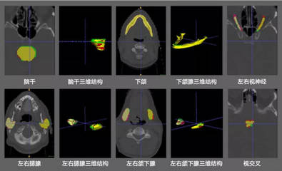 从头颈部癌症靶区勾画入手,「邃蓝智能」认为AI能解决的医疗痛点还有很多